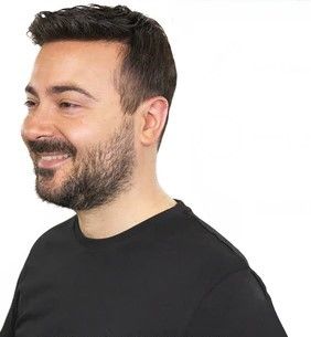 Protesi Per Capelli: Soluzione Innovativa Per La Calvizie Protesi Per Capelli: Soluzione Innovativa Per La Calvizie