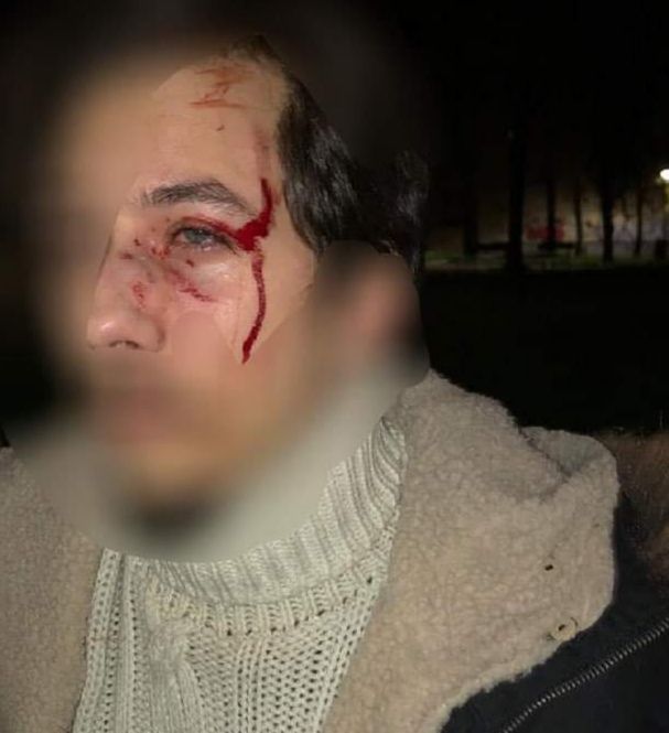 Torino, la denuncia di due militanti di destra: "Aggrediti sotto casa da 15 persone dei centri sociali"