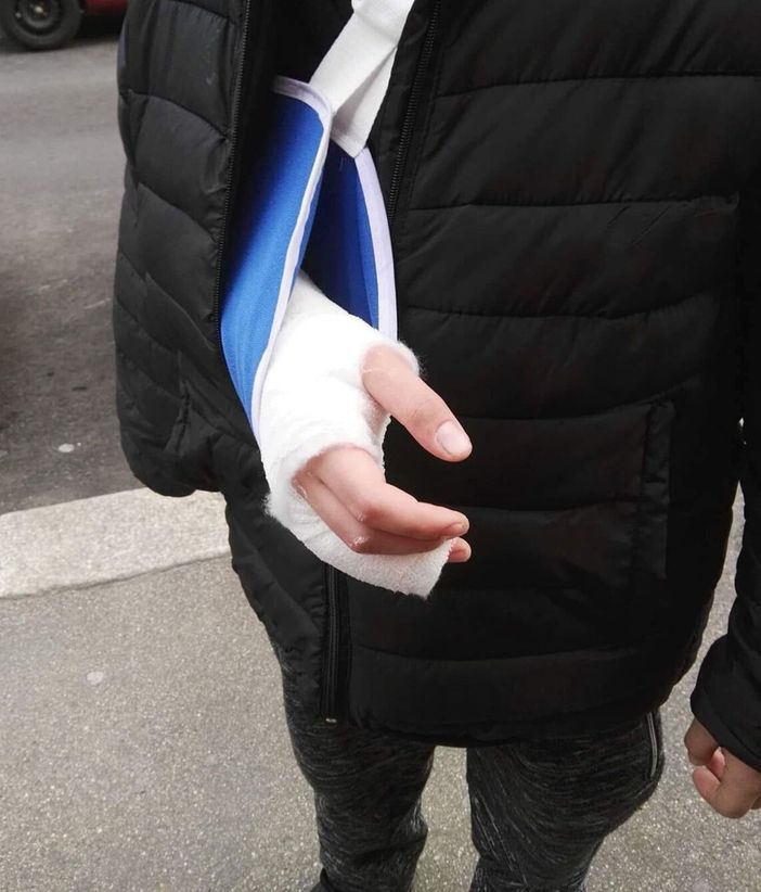 Mano fratturata a uno studente di una scuola media di Torino: padre denuncia professore Mano fratturata a uno studente di una scuola media di Torino: padre denuncia professore