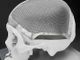 Come funziona la tecnologia SLM nella stampa 3D in metallo