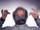 La Calvizie e l'Emotività: Il Trapianto di Capelli come Soluzione Ottimale