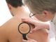 La &quot;Vitiligine Week&quot; arriva a Torino, incontri gratuiti con i dermatologi: le info