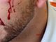 Carcere di Ivrea, detenuto aggredisce un poliziotto e gli spacca un sopracciglio. Osapp: &quot;Si dichiari lo stato di emergenza&quot;