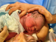 neonato