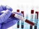 Coronavirus, crescono ricoverati generali (+19) e terapie intensive (+7)