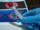 Coronavirus, 16 contagi e 51 guariti nelle ultime 24 ore in Piemonte. Torna a due cifre il numero di ricoverati in terapia intensiva