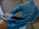 donazione di sangue