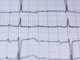 Come viene svolto un elettrocardiogramma