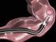 Cancro all'intestino, da UniTO la scoperta per facilitare la lotta al gene &quot;incurabile&quot;