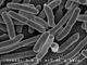 E. Coli Bacteria - Credit: NIAID