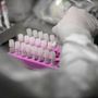 Covid, casi in aumento a luglio: anche il Sars-CoV-2 ha rialzato la testa