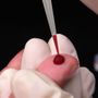 Lotta all'Hiv: a Torino 1300 test l'anno grazie al progetto Fast Track City Lotta all'Hiv: a Torino 1300 test l'anno grazie al progetto Fast Track City