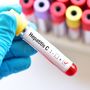 L’obiettivo 2030 passa da Torino: il Piemonte accelera sulla caccia al virus dell’epatite