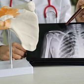 Latarjet artroscopica: cos’è, quando serve, tempi di recupero