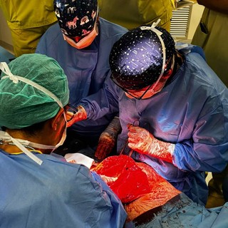 Chirurgia, da Moncalieri la svolta contro le infezioni: al via la sperimentazione sulle suture