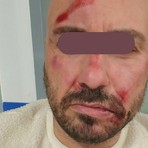 Filippo, la vittima dell'aggressione