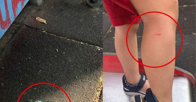 A sinistra i cocci di vetro e a destra il bimbo ferito