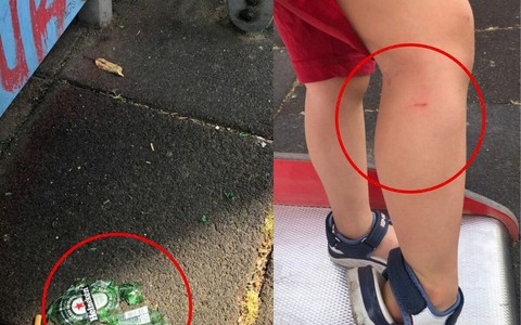 A sinistra i cocci di vetro e a destra il bimbo ferito