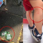 A sinistra i cocci di vetro e a destra il bimbo ferito