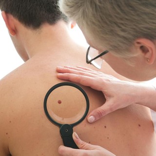 A Torino visite dermatologiche gratuite su prenotazione per l’idrosadenite suppurativa