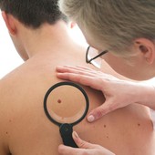 A Torino visite dermatologiche gratuite su prenotazione per l’idrosadenite suppurativa