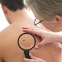 A Torino visite dermatologiche gratuite su prenotazione per l’idrosadenite suppurativa A Torino visite dermatologiche gratuite su prenotazione per l’idrosadenite suppurativa