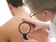 A Torino visite dermatologiche gratuite su prenotazione per l’idrosadenite suppurativa A Torino visite dermatologiche gratuite su prenotazione per l’idrosadenite suppurativa
