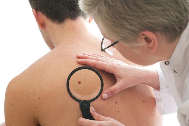 A Torino visite dermatologiche gratuite su prenotazione per l’idrosadenite suppurativa