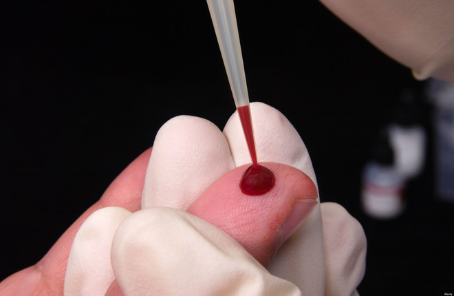 Lotta all'Hiv: a Torino 1300 test l'anno grazie al progetto Fast Track City Lotta all'Hiv: a Torino 1300 test l'anno grazie al progetto Fast Track City