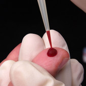 Lotta all'Hiv: a Torino 1300 test l'anno grazie al progetto Fast Track City