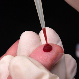 Lotta all'Hiv: a Torino 1300 test l'anno grazie al progetto Fast Track City