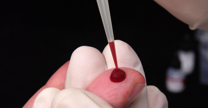 Lotta all'Hiv: a Torino 1300 test l'anno grazie al progetto Fast Track City Lotta all'Hiv: a Torino 1300 test l'anno grazie al progetto Fast Track City