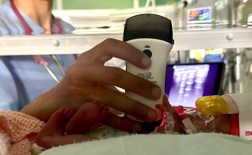 Ecografia senza fili fin dal primo respiro: all'ospedale Sant’Anna valutazioni “a misura di neonato”