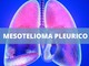 Amianto nelle scuole: la Corte d’Appello di Trieste condanna il Ministero dell’Istruzione e del merito per una vittima di mesotelioma