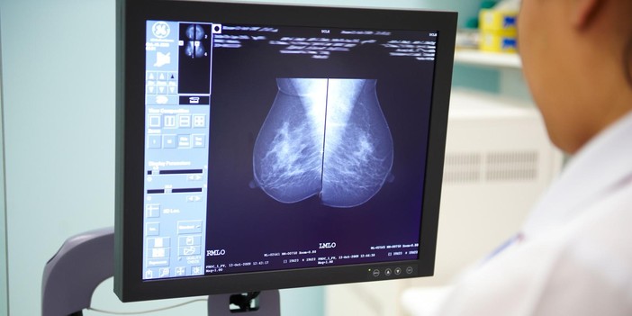 Lo screening può essere più efficace grazie a una start up torinese