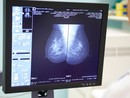 Lo screening può essere più efficace grazie a una start up torinese Lo screening può essere più efficace grazie a una start up torinese