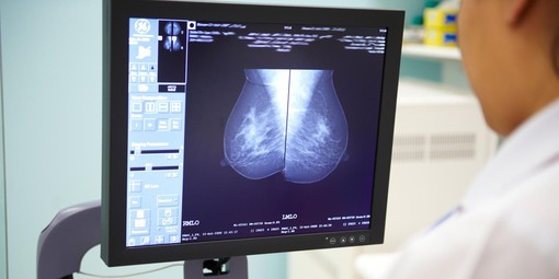 Lo screening può essere più efficace grazie a una start up torinese