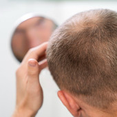 La Tua Guida Completa alle Patch Cutanee per la Crescita dei Capelli: Cosa Devi Sapere