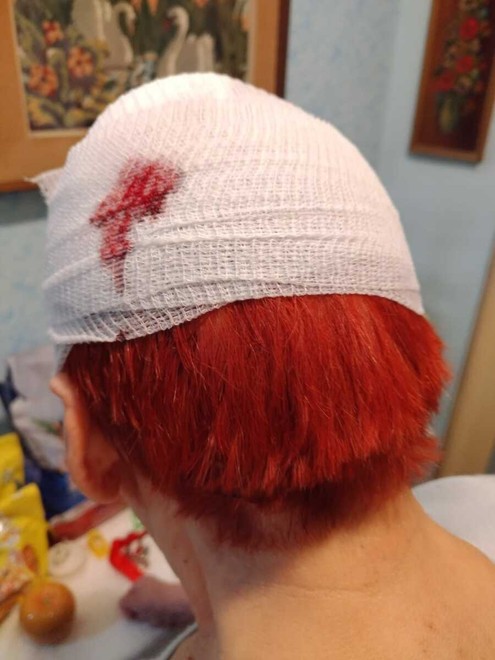 Luciana dopo la caduta