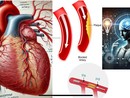 Quando fare l’angioplastica coronarica? Ora lo dice l’Intelligenza artificiale: ecco lo studio di Unito, Molinette e Università di Catania