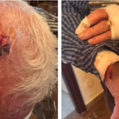 Le immagini dell'aggressione dell'86enne in via Boccherini