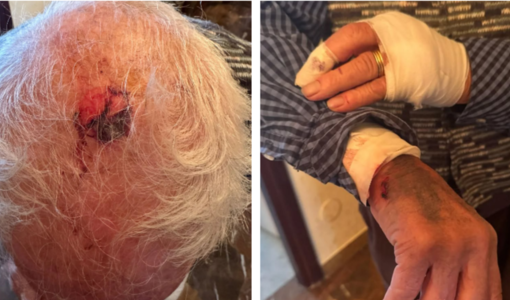 Le immagini dell'aggressione dell'86enne in via Boccherini Le immagini dell'aggressione dell'86enne in via Boccherini
