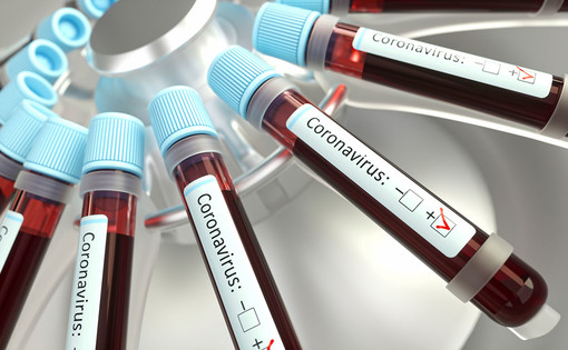 Coronavirus, ancora un decesso e più di cento nuovi positivi in Piemonte