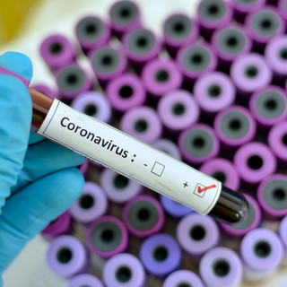 Coronavirus, lo stop alle manifestazioni &quot;spegne&quot; anche il falò del Martedì Grasso