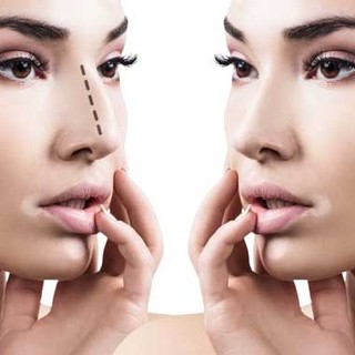 Differenza tra Chirurgia Plastica ed Estetica: Cosa Cambia e a Chi Rivolgersi