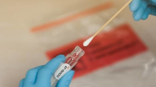 Coronavirus in Piemonte: 952 nuovi positivi, scendono a 330 le terapie intensive