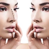 Differenza tra Chirurgia Plastica ed Estetica: Cosa Cambia e a Chi Rivolgersi