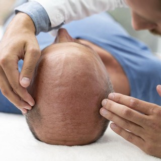 Comparativo delle cliniche di trapianto capelli in Turchia (2026)