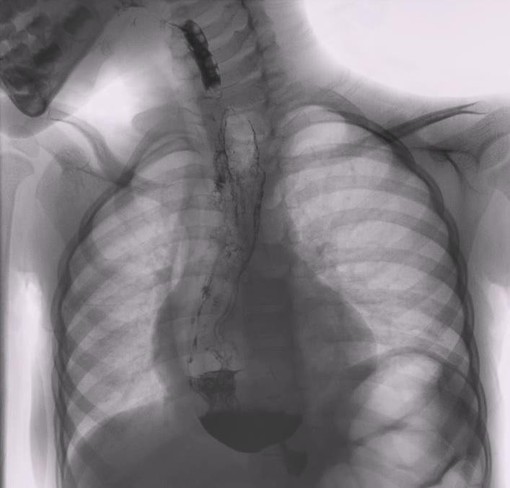 A Torino il 7° Congresso Nazionale della Società Italiana per lo Studio delle Malattie dell’Esofago