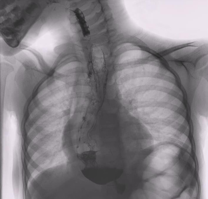 A Torino il 7° Congresso Nazionale della Società Italiana per lo Studio delle Malattie dell’Esofago